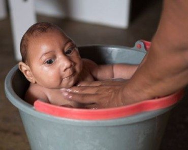 Is Zika Virus Really to Blame for Birth Defects?