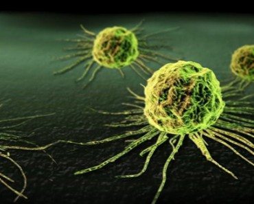 T-Therapy: A Major Breakthrough in Cancer Treatment