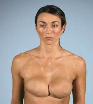 17 Different Types Of Boobs â‹†